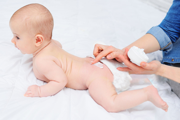 راهکارهای خانگی مانند استفاده از ژل آلوئه‌ورا، پودر بچه، جوش شیرین و خیار می‌توانند در کاهش التهاب و خارش ناشی از عرق سوز شدن مؤثر باشند.